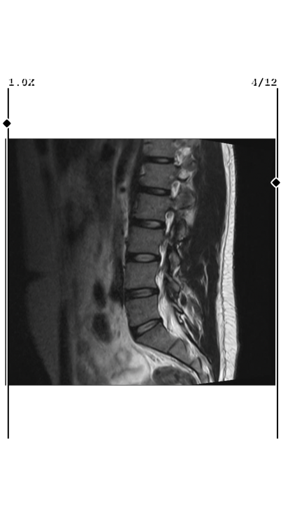 IMG_0206.thumb.png.e9cb837ddd92f26de583bf569a600357.png