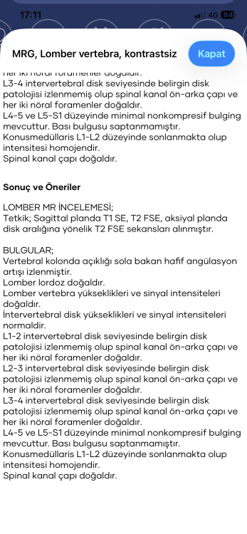 IMG_0208.thumb.png.0ef8bdb15e0edd99cf55109882c6ddef.png